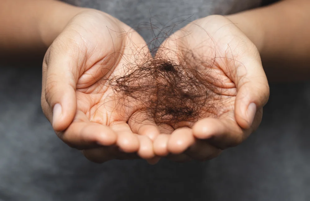 อาหารบำรุงผมขาดหลุดร่วง